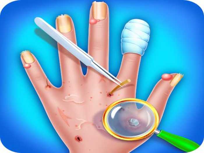 Fun Baby Care Kids Game – Hand Skin Doctor Unblocked