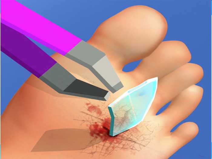 Foot Doctor : Feet Care Unblocked