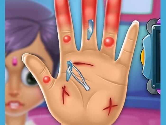 Hand Surgery Doctor Care Game! Unblocked
